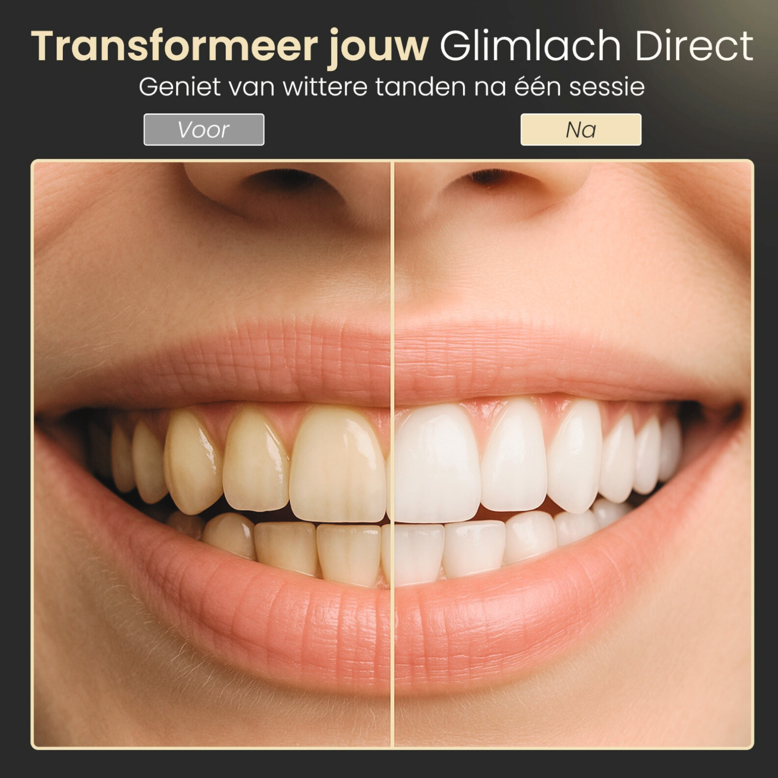 M's Corner Tandenbleekset